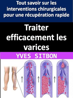 cover image of Traiter efficacement les varices